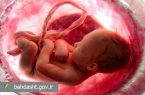 راه اندازی خط ویژه مشاوره تلفنی حفظ حیات جنین