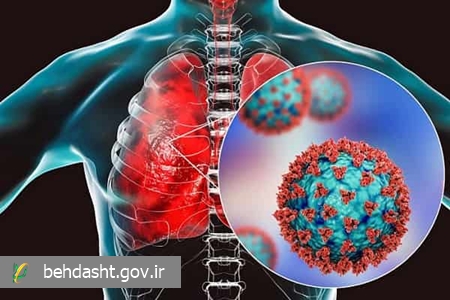 آخرین وضعیت عفونت های تنفسی در کشور